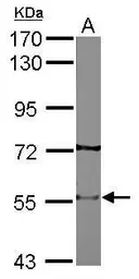 Anti-AChR beta 2 antibody [N1C1] used in Western Blot (WB). GTX113654