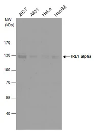 Anti-IRE1 alpha antibody [N1N2], N-term used in Western Blot (WB). GTX113682