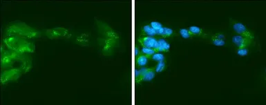 Anti-Factor IX antibody [N3C3] used in Immunocytochemistry/ Immunofluorescence (ICC/IF). GTX113689