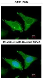 Anti-Fibrinogen beta antibody [C1C3] used in Immunocytochemistry/ Immunofluorescence (ICC/IF). GTX113694