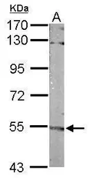 Anti-FMO3 antibody [C1C3] used in Western Blot (WB). GTX113698