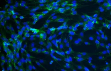 Anti-Connexin 43 antibody used in Immunocytochemistry/ Immunofluorescence (ICC/IF). GTX11370