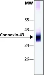 Anti-Connexin 43 antibody used in Western Blot (WB). GTX11370