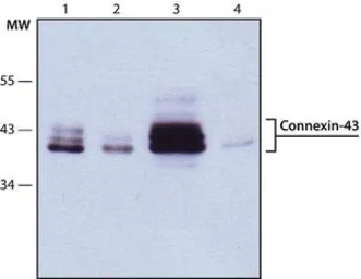 Anti-Connexin 43 antibody used in Western Blot (WB). GTX11370