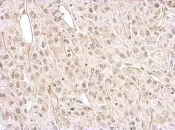 Anti-NMDAR2A antibody [C1C2], Internal used in IHC (Paraffin sections) (IHC-P). GTX113717