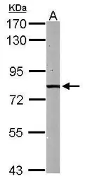 Anti-HADHA antibody [N2C1], Internal used in Western Blot (WB). GTX113727
