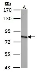 Anti-HADHA antibody [N2C1], Internal used in Western Blot (WB). GTX113727