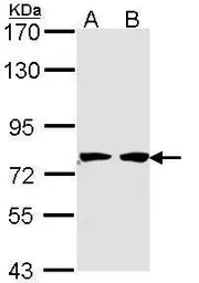 Anti-HADHA antibody [N2C1], Internal used in Western Blot (WB). GTX113727