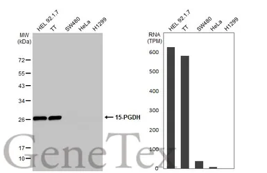 Anti-15-PGDH antibody used in Western Blot (WB). GTX113740