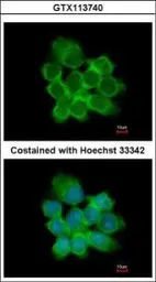 Anti-15-PGDH antibody used in Immunocytochemistry/ Immunofluorescence (ICC/IF). GTX113740