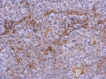 Anti-CD41 antibody [N2C1], Internal used in IHC (Paraffin sections) (IHC-P). GTX113758