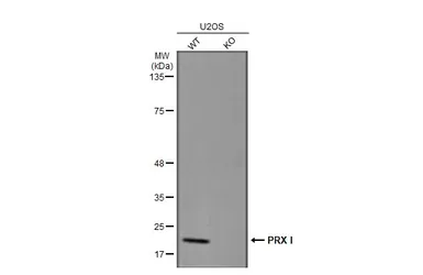 Anti-PRX I antibody [N1C3] used in Western Blot (WB). GTX113793