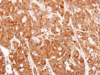 Anti-PRX I antibody [N1C3] used in IHC (Paraffin sections) (IHC-P). GTX113793