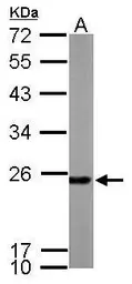 Anti-PRX I antibody [N1C3] used in Western Blot (WB). GTX113793