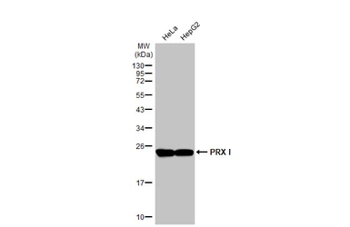 Anti-PRX I antibody [N1C3] used in Western Blot (WB). GTX113793