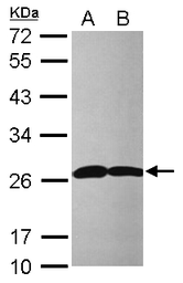 Anti-PRX I antibody [N1C3] used in Western Blot (WB). GTX113793