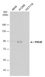 Anti-PDE4B antibody [C2C3], C-term used in Western Blot (WB). GTX113798