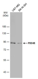 Anti-PDE4B antibody [C2C3], C-term used in Western Blot (WB). GTX113798