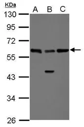 Anti-RAD23B antibody used in Western Blot (WB). GTX113820