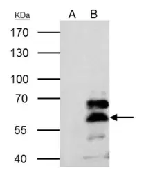 Anti-Retinoid X Receptor alpha antibody used in Immunoprecipitation (IP). GTX113828