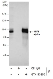 Anti-HNF1 alpha antibody [N1N3] used in Immunoprecipitation (IP). GTX113850