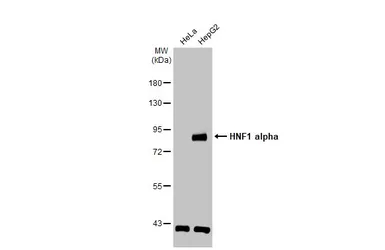 Anti-HNF1 alpha antibody [N1N3] used in Western Blot (WB). GTX113850