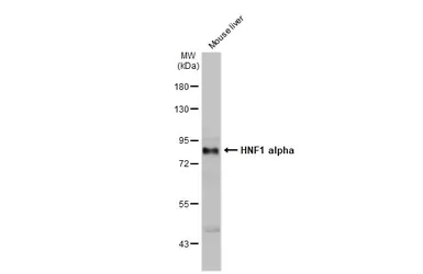 Anti-HNF1 alpha antibody [N1N3] used in Western Blot (WB). GTX113850