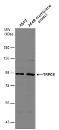 Anti-TRPC6 antibody [N1N3] used in Western Blot (WB). GTX113858