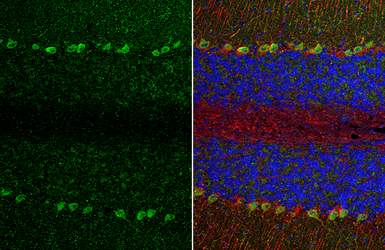 Anti-TRPC6 antibody [N1N3] used in IHC (Paraffin sections) (IHC-P). GTX113858