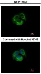 Anti-TRPC6 antibody [C2C3], C-term used in Immunocytochemistry/ Immunofluorescence (ICC/IF). GTX113859