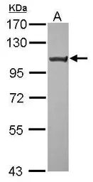 Anti-TRPC6 antibody [C2C3], C-term used in Western Blot (WB). GTX113859