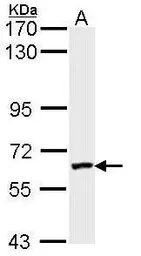 Anti-FXR1 antibody used in Western Blot (WB). GTX113867