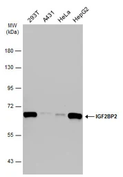 Anti-IGF2BP2 antibody used in Western Blot (WB). GTX113923