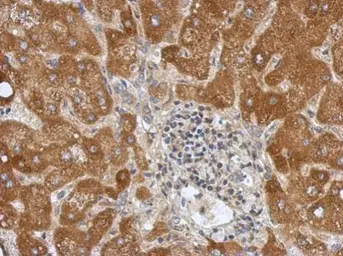 Anti-Calpain 10 antibody [N2C2], Internal used in IHC (Paraffin sections) (IHC-P). GTX113930