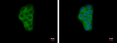 Anti-Calcium binding protein p22 antibody used in Immunocytochemistry/ Immunofluorescence (ICC/IF). GTX113936