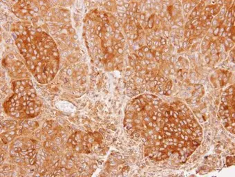 Anti-Calcium binding protein p22 antibody used in IHC (Paraffin sections) (IHC-P). GTX113936