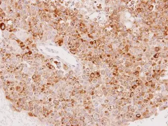 Anti-UGT1A6 antibody used in IHC (Paraffin sections) (IHC-P). GTX113980