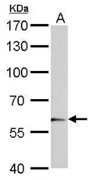 Anti-UGT1A6 antibody used in Western Blot (WB). GTX113980