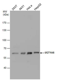 Anti-UGT1A6 antibody used in Western Blot (WB). GTX113980