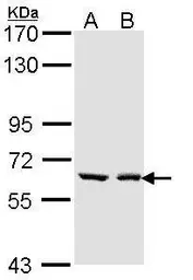 Anti-UGT1A6 antibody used in Western Blot (WB). GTX113980