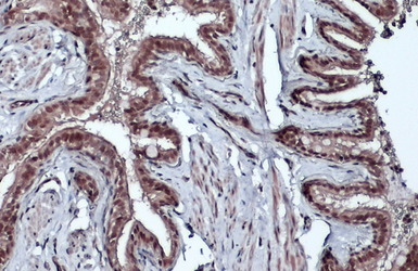 Anti-Bmi1 antibody used in IHC (Paraffin sections) (IHC-P). GTX114008