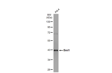 Anti-Bmi1 antibody used in Western Blot (WB). GTX114008