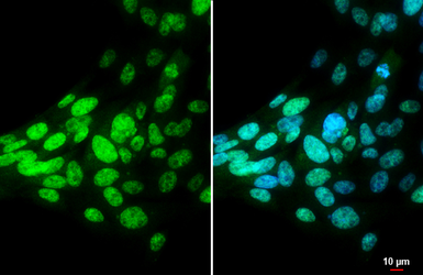 Anti-Bmi1 antibody used in Immunocytochemistry/ Immunofluorescence (ICC/IF). GTX114008