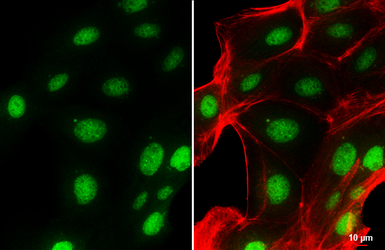 Anti-Bmi1 antibody used in Immunocytochemistry/ Immunofluorescence (ICC/IF). GTX114008