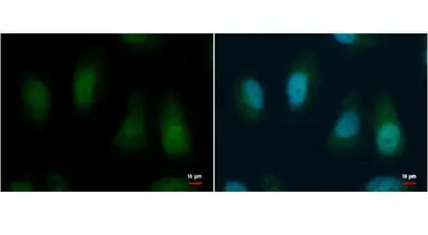 Anti-Bmi1 antibody used in Immunocytochemistry/ Immunofluorescence (ICC/IF). GTX114008