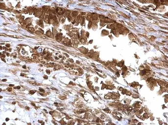 Anti-Bmi1 antibody used in IHC (Paraffin sections) (IHC-P). GTX114008