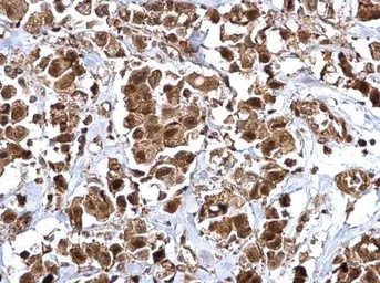 Anti-Bmi1 antibody used in IHC (Paraffin sections) (IHC-P). GTX114008