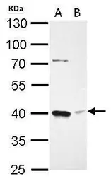 Anti-Bmi1 antibody used in Western Blot (WB). GTX114008