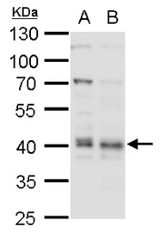 Anti-Bmi1 antibody used in Western Blot (WB). GTX114008