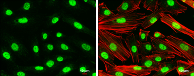 Anti-Nurr1 antibody used in Immunocytochemistry/ Immunofluorescence (ICC/IF). GTX114045